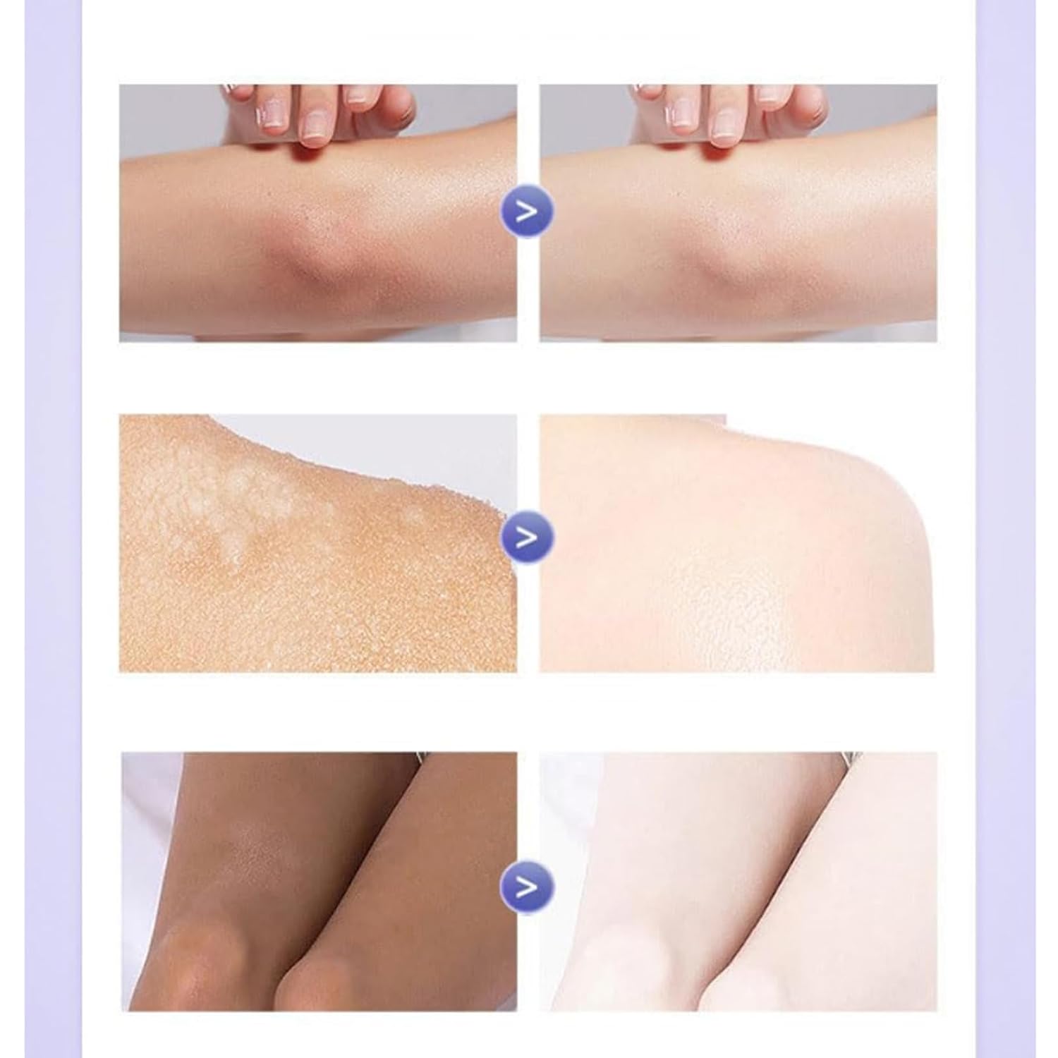 Omenfee Cold White Skin All Over | (Both for Men & Women)